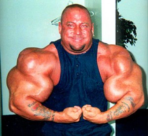 Yes, they are real. Greg Valentino - The man whose arms exploded.