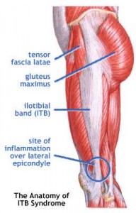 Knee pain? Hip pain? Low back pain while running? Check your ITB.